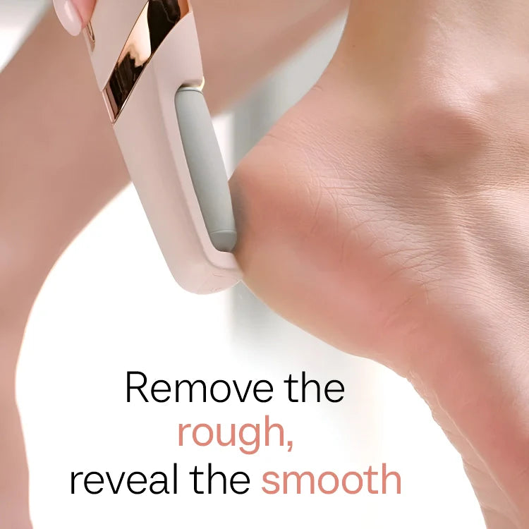 Prime Foot Callus Remover - Dead Skin Remover