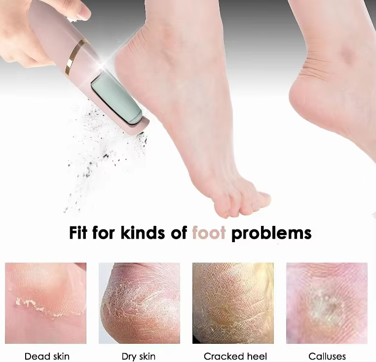 Prime Foot Callus Remover - Dead Skin Remover